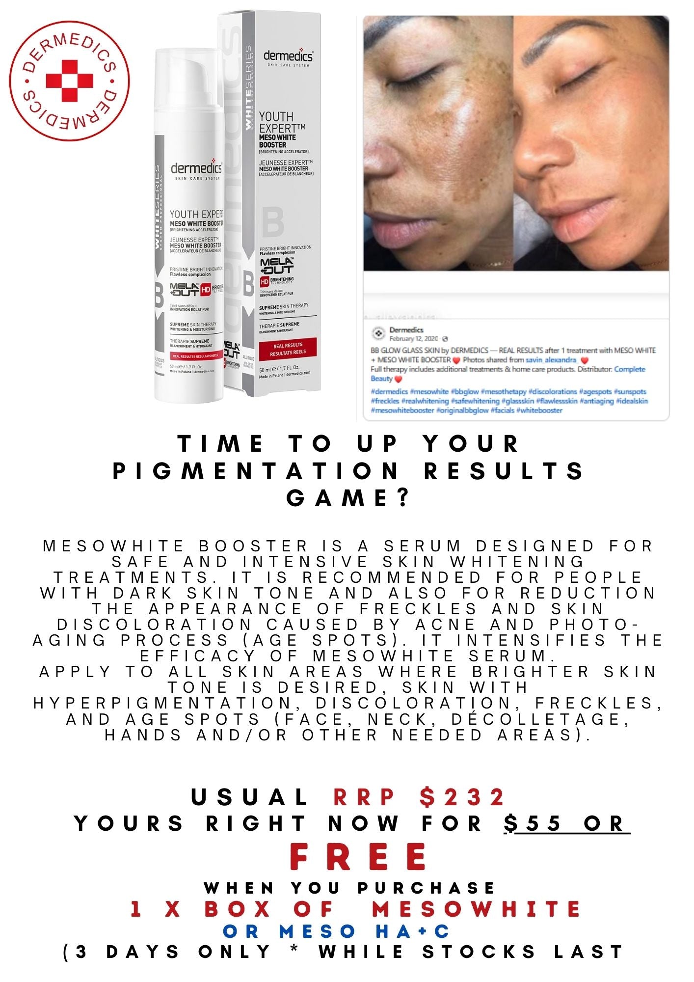 Pigmentation Results super Booster